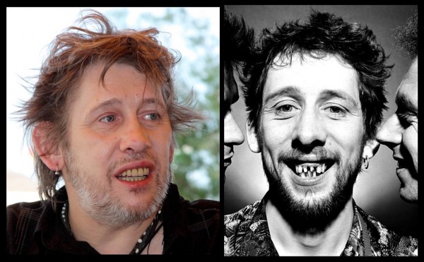 the pogues shane macgowan bad teeth then and now